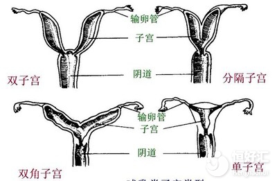 雙角子宮影響懷孕嗎？看完不敢相信自己的眼睛