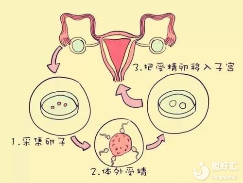 試管嬰兒“回家”過程你都知道嗎？真相在這里