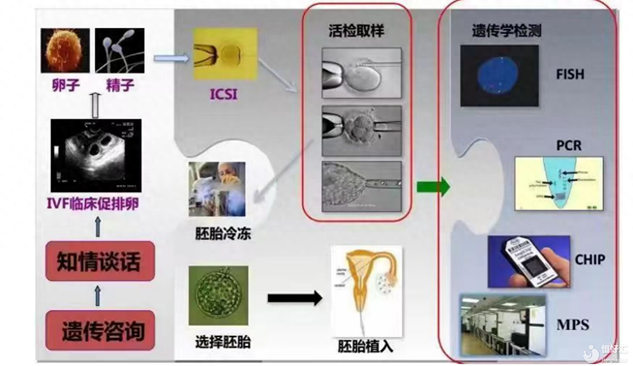 遺傳性疾病父母能生健康孩子？哪些人適合做“第三代試管嬰兒”